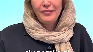 بلفاروپلاستی در کلینیک گونه