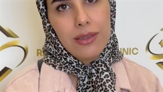 نتیجه کاشت ابروی طبیعی بعد از دوهفته