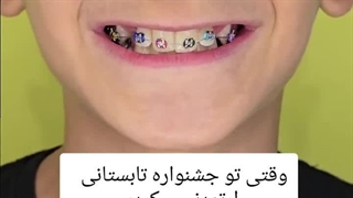 ماهان جان دندان نهفته هم داشتن که قراره با ارتودنسی درمان بشه