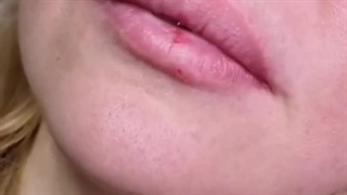 این ویدیو نشان می‌دهد حجم‌دهی لب چگونه باید باشد؛ واقعی، کم، دقیق | آی گل