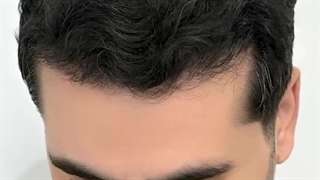 اردبیل کاشت لند