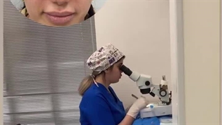 کاشت ابرو توسط تیم حرفه ای