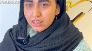 اصلاح فرم ابرو به روش سوپر نچرال