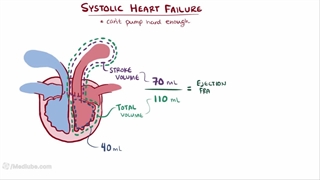 Congestive Heart Failure (CHF) Explained
