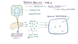 Diabetes mellitus (type 1, type 2) & diabetic ketoacidosis (DKA)