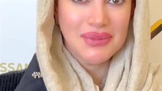 اصلاح فرم ابرو به روش سوپر نچرال