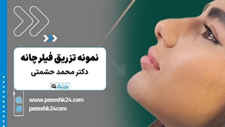 تاثیر فیلر چانه در زیبایی توسط دکتر محمد حشمتی در تهران- پزشک 24