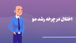 علت اصلی ریزش مو چیست؟