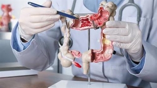 این علائم سرطان روده را هرگز نادیده نگیرید
