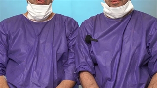 کاشت موی موفق دوقلوها
