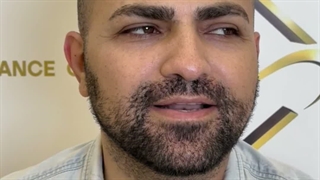 کاشت مو با بالاترین تراکم در کلینیک سینا همان رنسانس معروف
