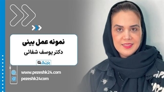 تجربه رضایت‌بخش زیباجو از عمل بینی طبیعی در تهران - پزشک 24