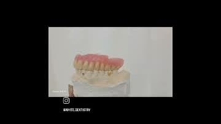 لابراتور دندانسازی سپید در لنگرود