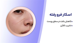 چگونه اسکار فرورفته را از بین ببریم؟