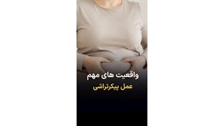 واقعیت های مهم پیکرتراشی