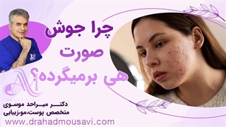 چرا جوش صورت بعد از درمان دوباره برمی‌گردد؟