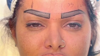 کاشت ابرو به روش سوپر نچرال در کلینیک سینا همان رنسانس معروف