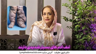 چرا بعضی از لنف اِدم ها خیلی شدید اند؟!