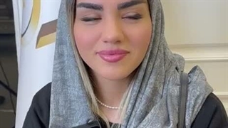 رضایت زیباجوی عزیز از کاشت ابرو به روش sut در کلینیک سینا