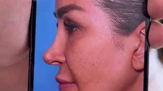 بهترین جراح بینی در شهر تهران