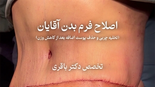 رسیدن به وزن ایده‌آل فقط نصف راهه!