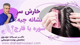 خارش سر از چیه قارچ یا شوره؟