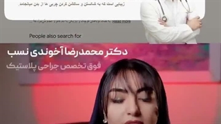 نمونه کار سئو لیپوساکشن