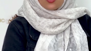 نتیجه کاشت ابرو بعد از 3 سال در کلینیک سینا همان رنسانس معروف