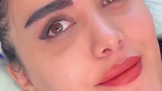 کاشت ابرو میکرو sut در کلینیک سینا همان رنسانس معروف