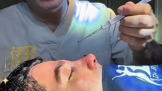 فیلم نمونه کار واقعی عمل بینی مردانه